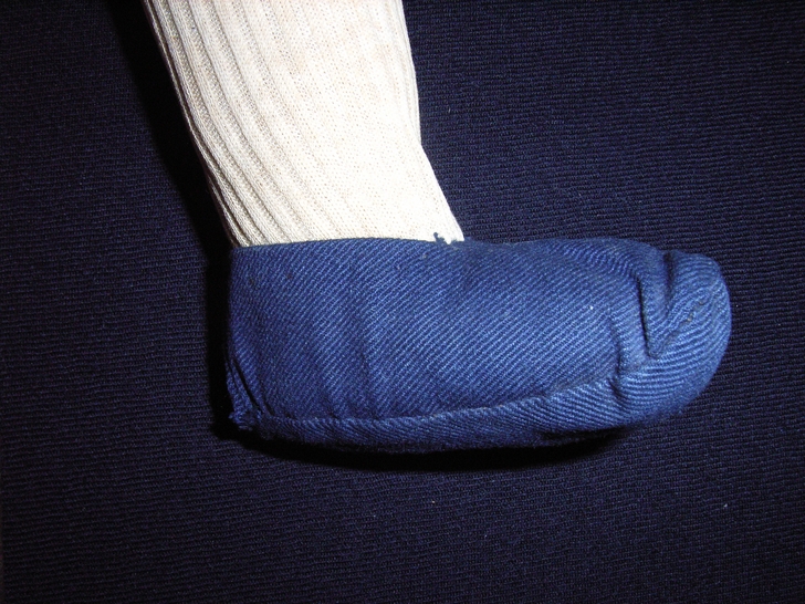 Piede destro dopo il restauro